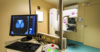 A Unidade Móvel ficará até 1º de dezembro em Xaxim e a previsão é de realizar 727 exames mamografia digital e 727 citopatológicos
